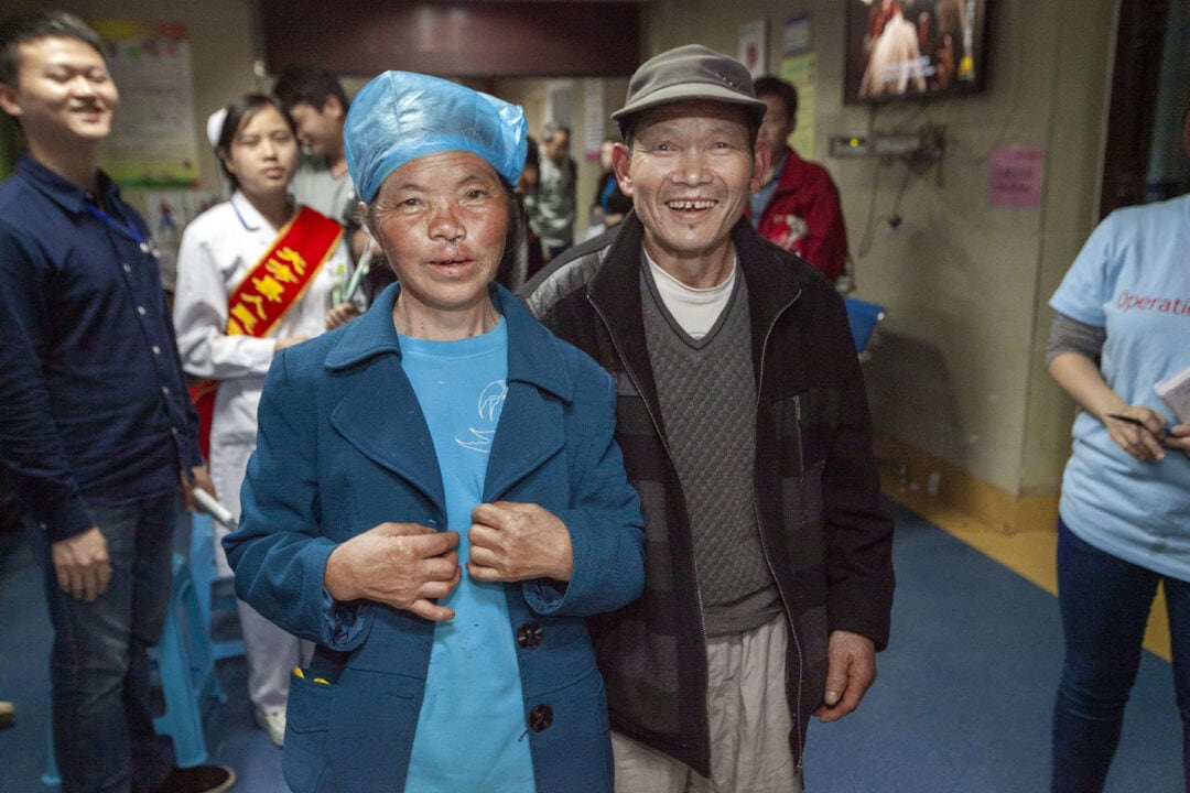 Shang Rong before her life-changing cleft surgery