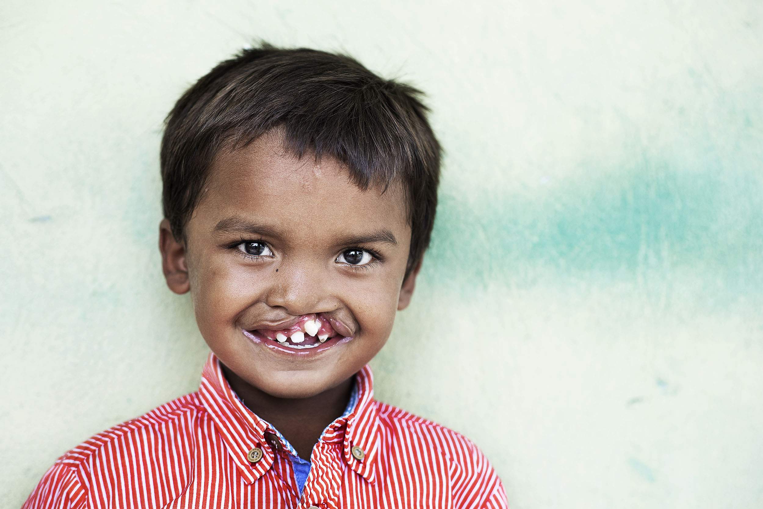 Charity Or Con?  The Operation Smile Controversy Explained - ws23k32