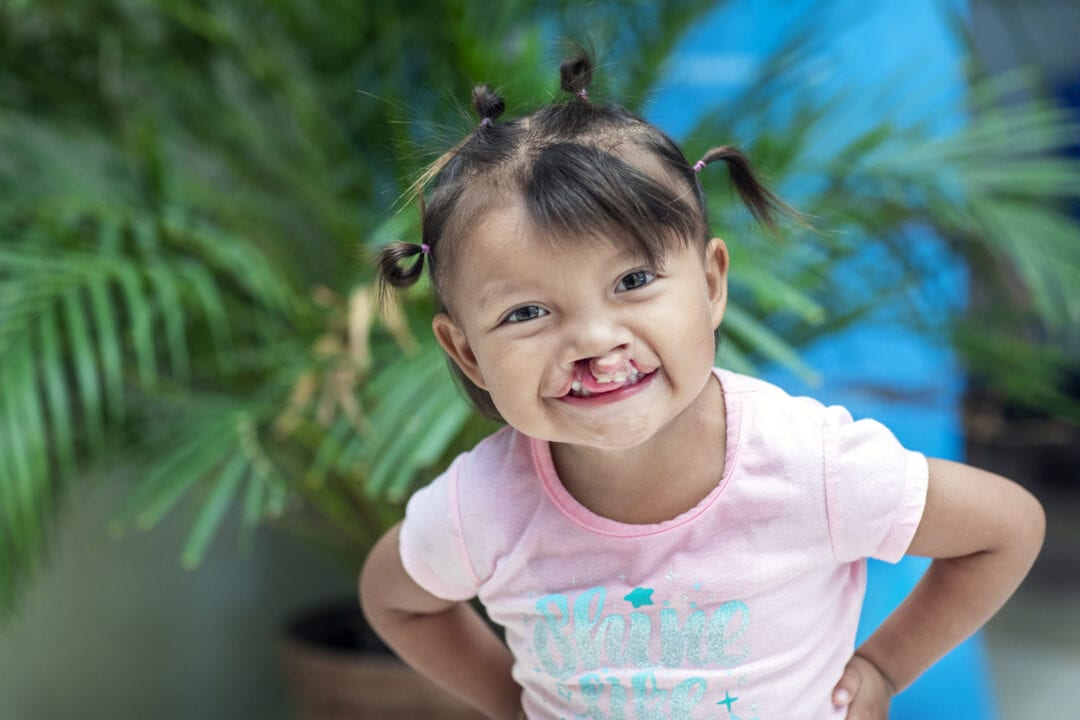 Luz before her life changing surgery