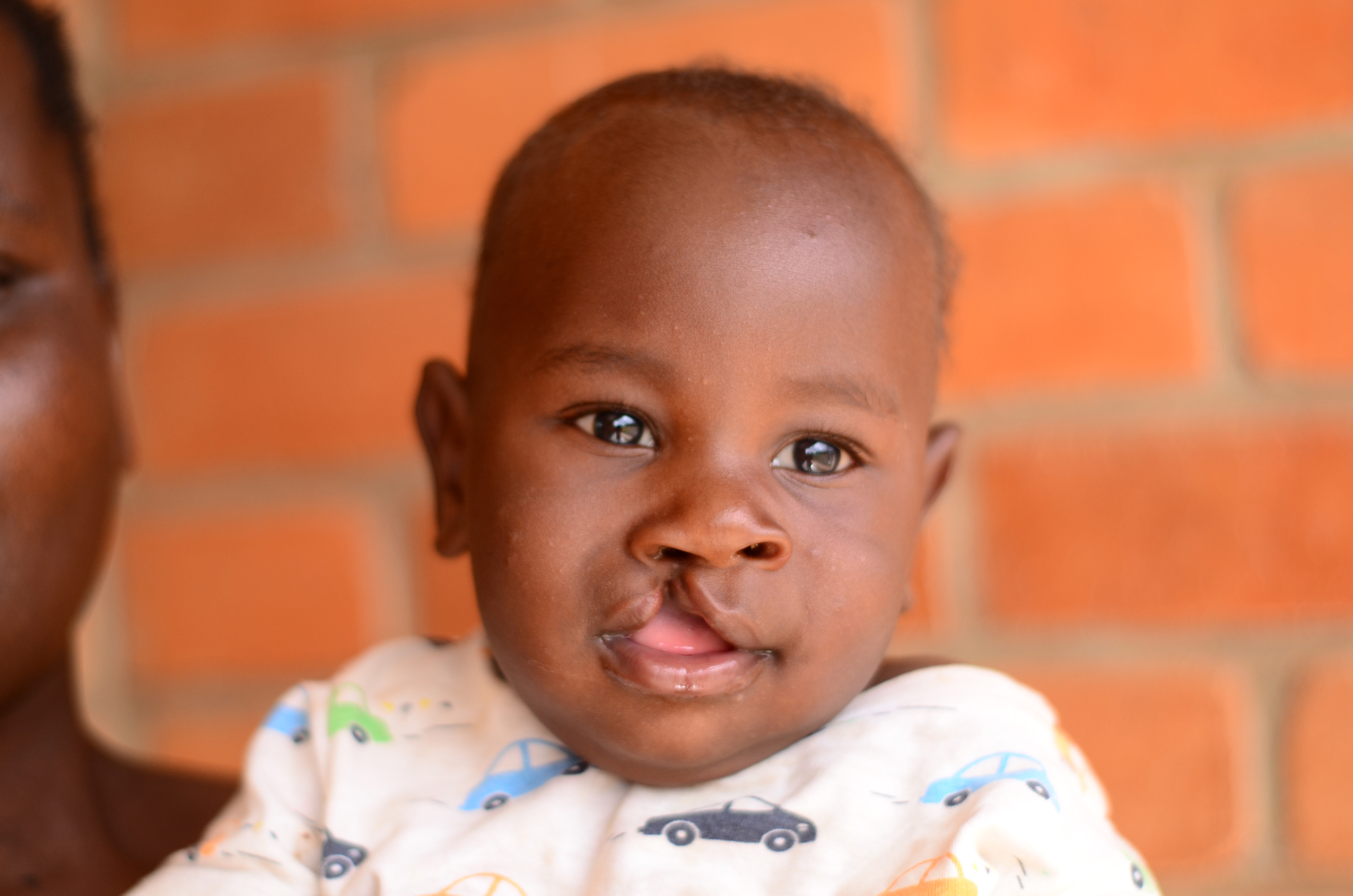 Charity Or Con?  The Operation Smile Controversy Explained - n6rplxk