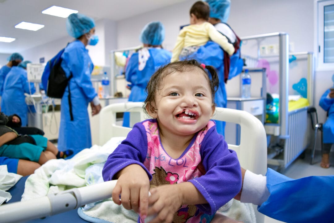 Baby girl smiles showing cleft lip