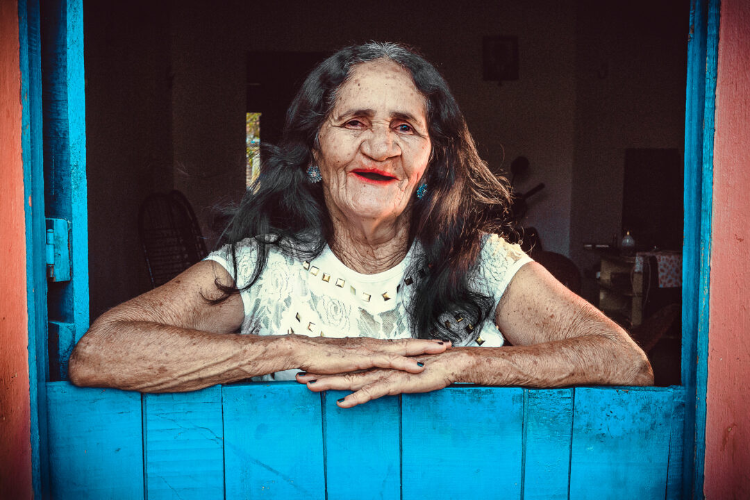Adult with cleft, after surgery.
