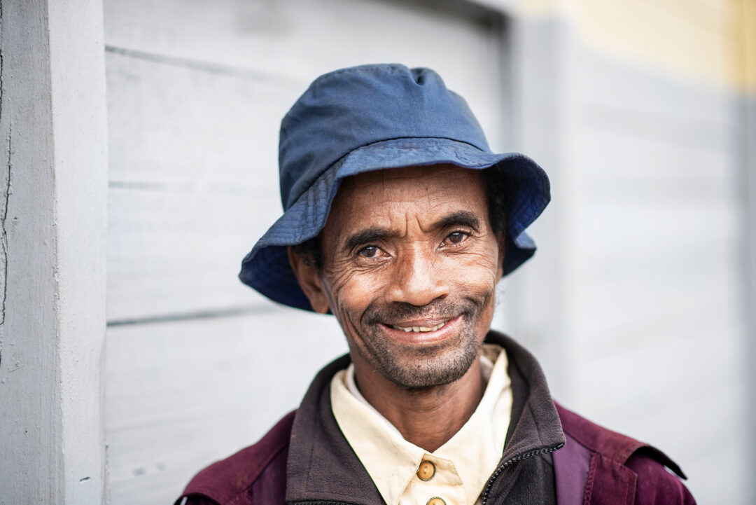 Male after cleft surgery. Photo: Rohanna Mertens)