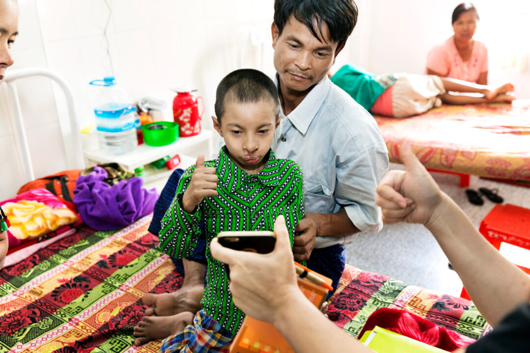 Phoe after cleft surgery. 