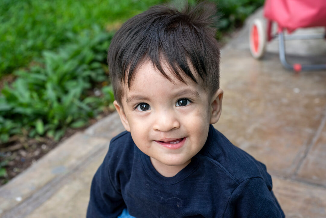 Arian a year after his cleft surgery. Photo:  Margherita Mirabella 