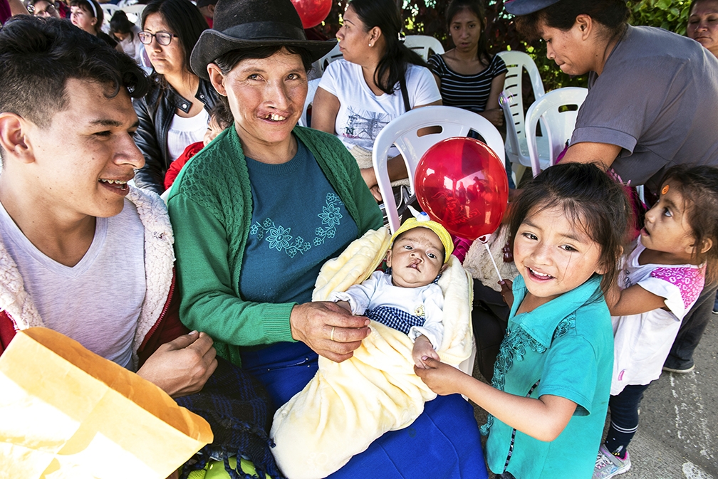 mother with cleft, holds son also with cleft
