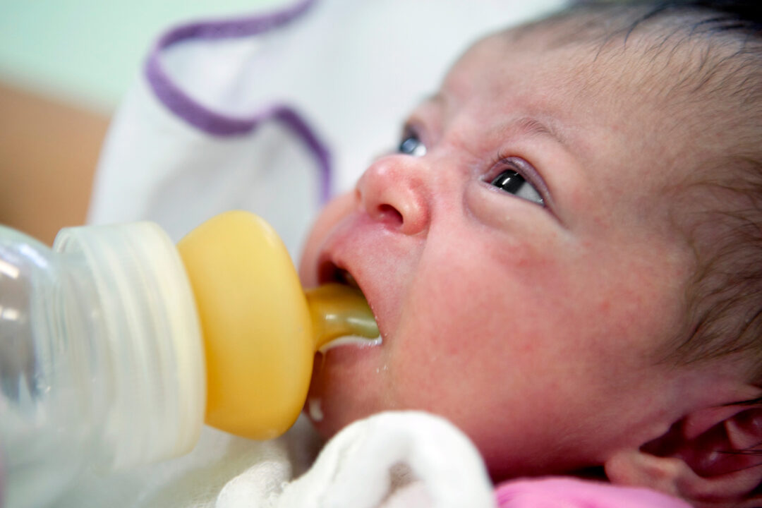 Newborn Alana using cleft feeding bottle