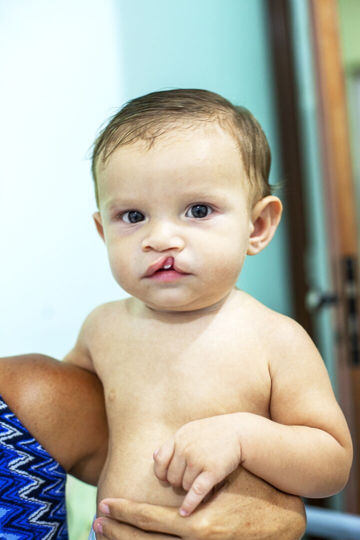 When Naira and Fredy arrived at the 2015 Operation Smile Brazil surgical programme, they were surrounded by other families who were just as hopeful for care. Photo: Paulo Fabre.