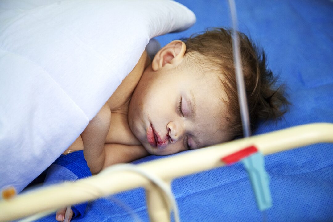 Fredy rests in the recovery room after receiving his life-changing operation. Photo: Paulo Fabre.
