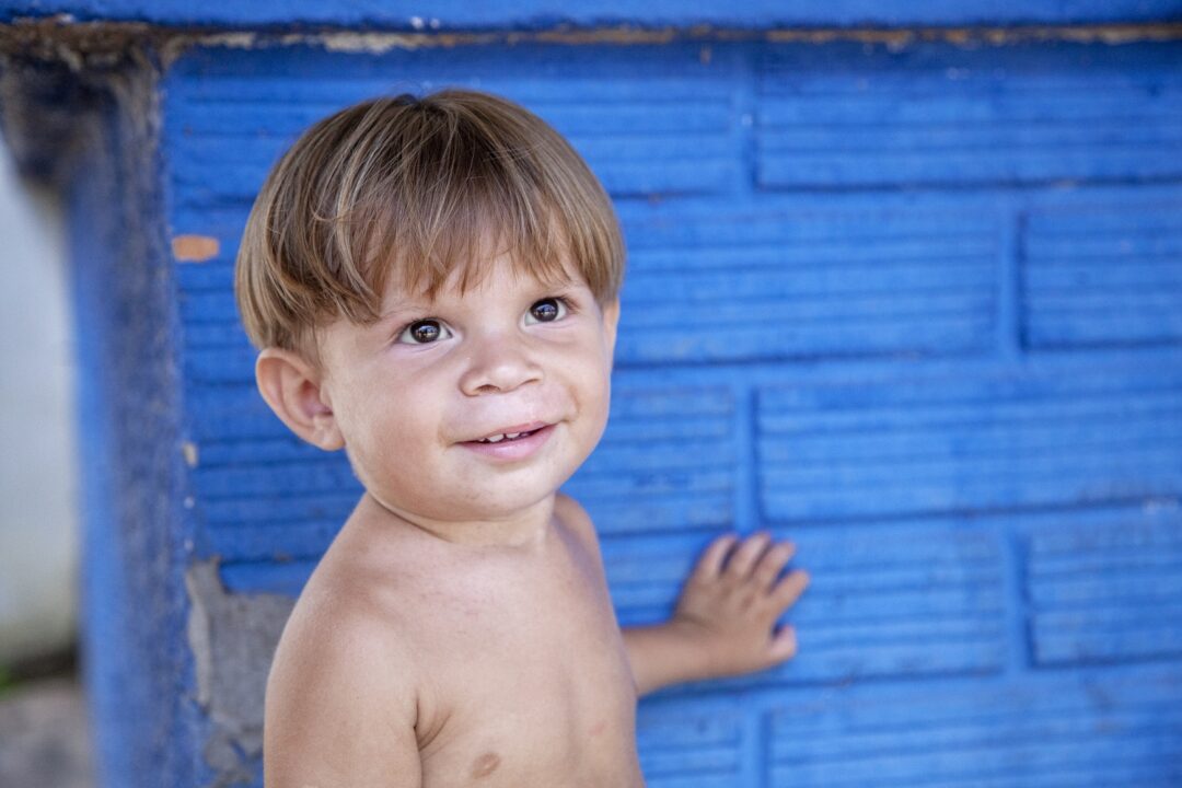 Fredy, one year after his cleft lip surgery. Photo: Paulo Fabre.