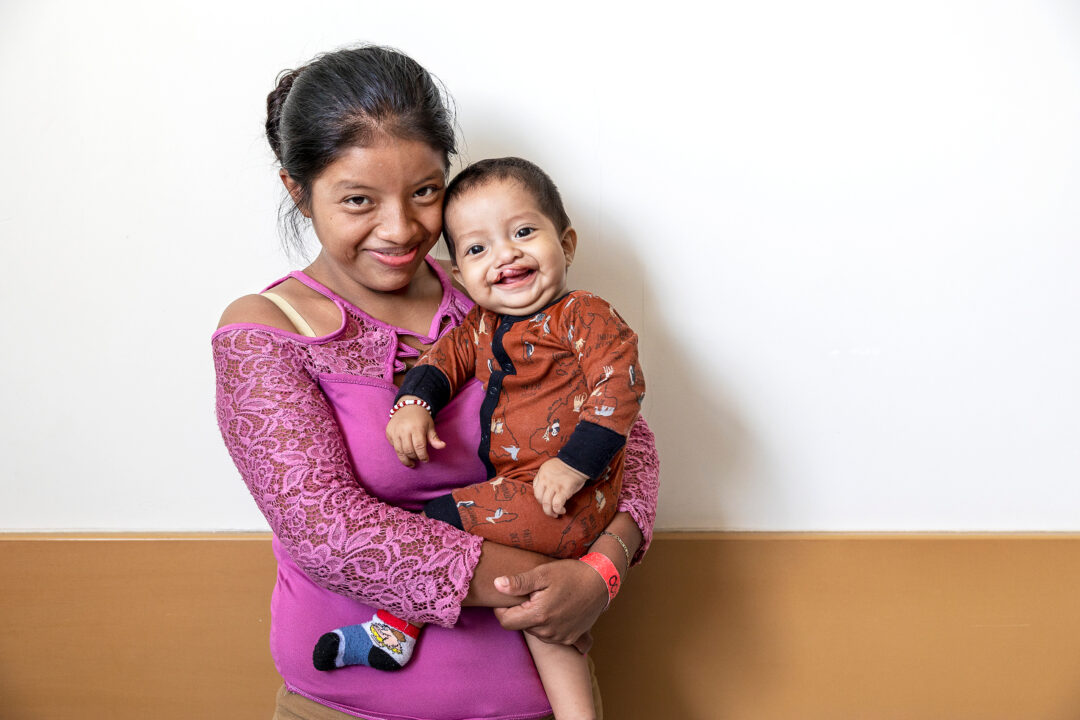 Six-month-old Edwin before cleft surgery. Photo - Lorenzo Monacelli