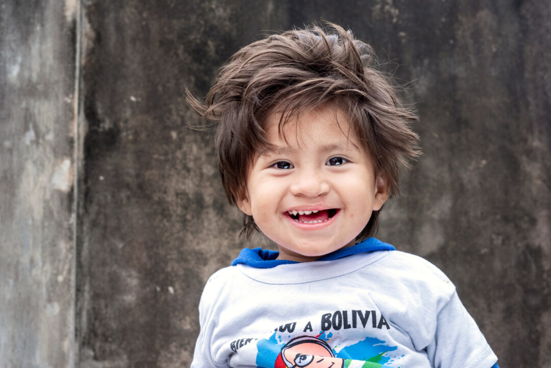 Damian after cleft surgery. Photo: Margherita Mirabella.