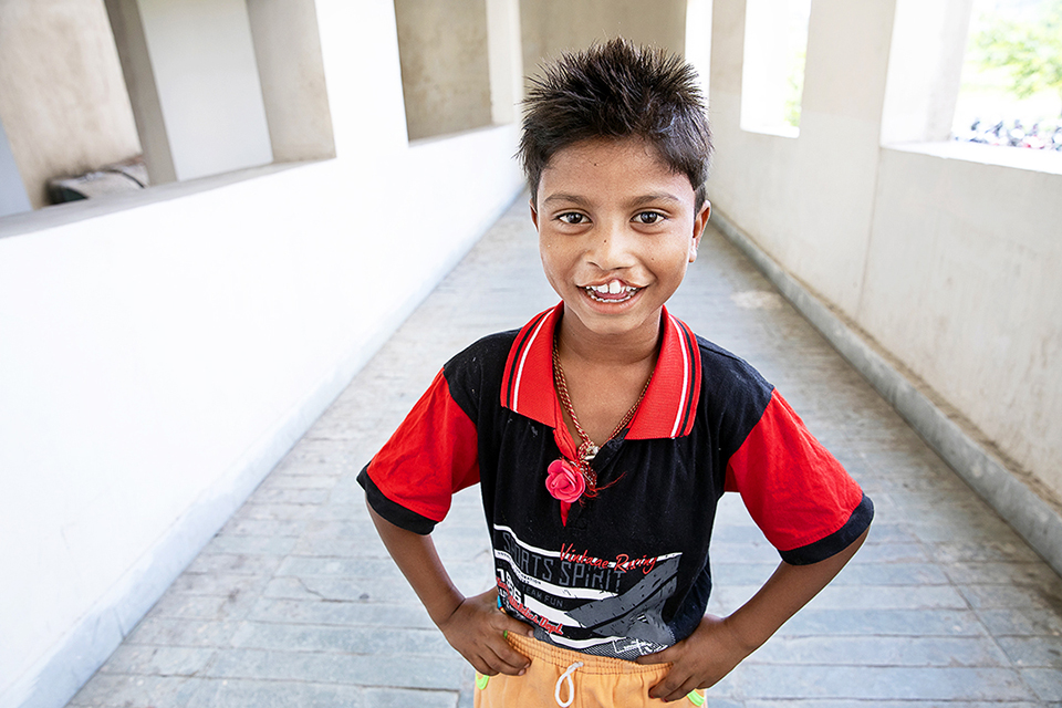Nine-year-old Bipul during patient announcement day at Operation Smile's 2018 medical programme in Durgapur, India. Photo: Jasmin Shah.