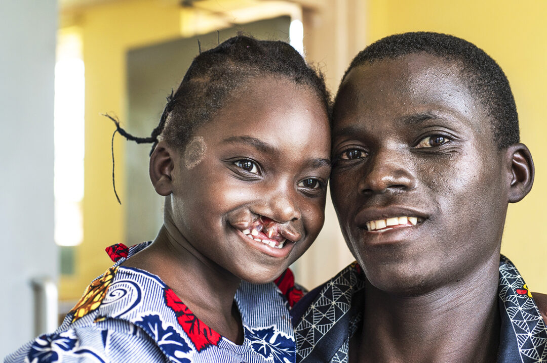 Taonga and his father before her surgery. Photo Margherita Mirabella