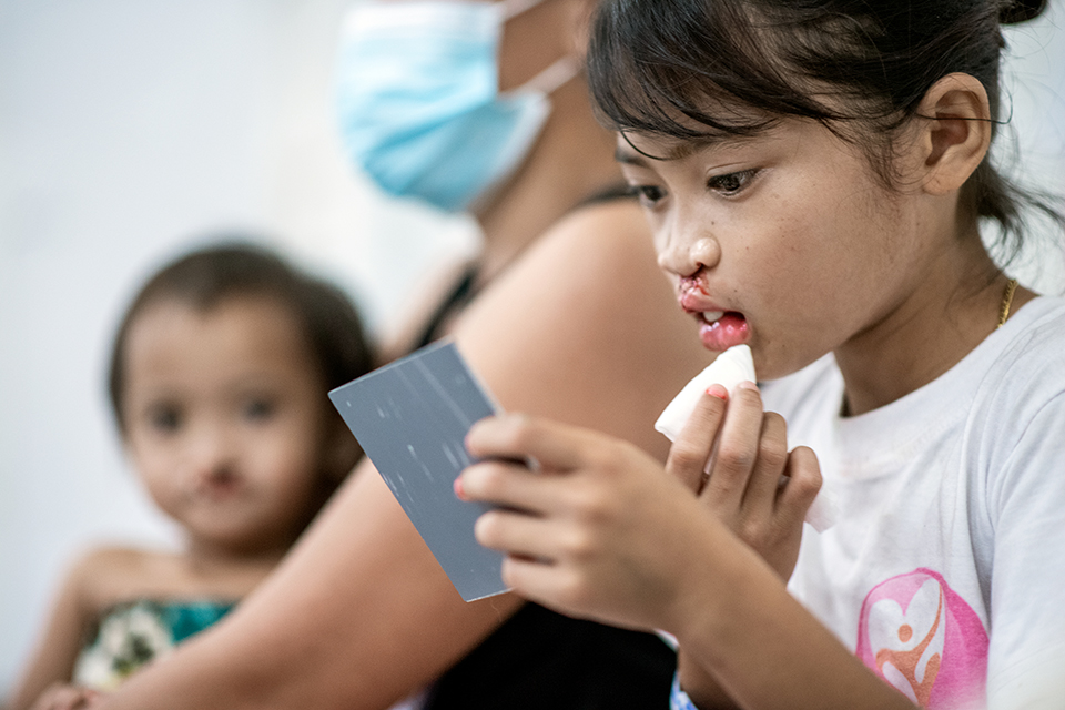 Nine year old Kisha dabs at her mouth with a tissue whilst looking into a handheld mirror after her surgery.