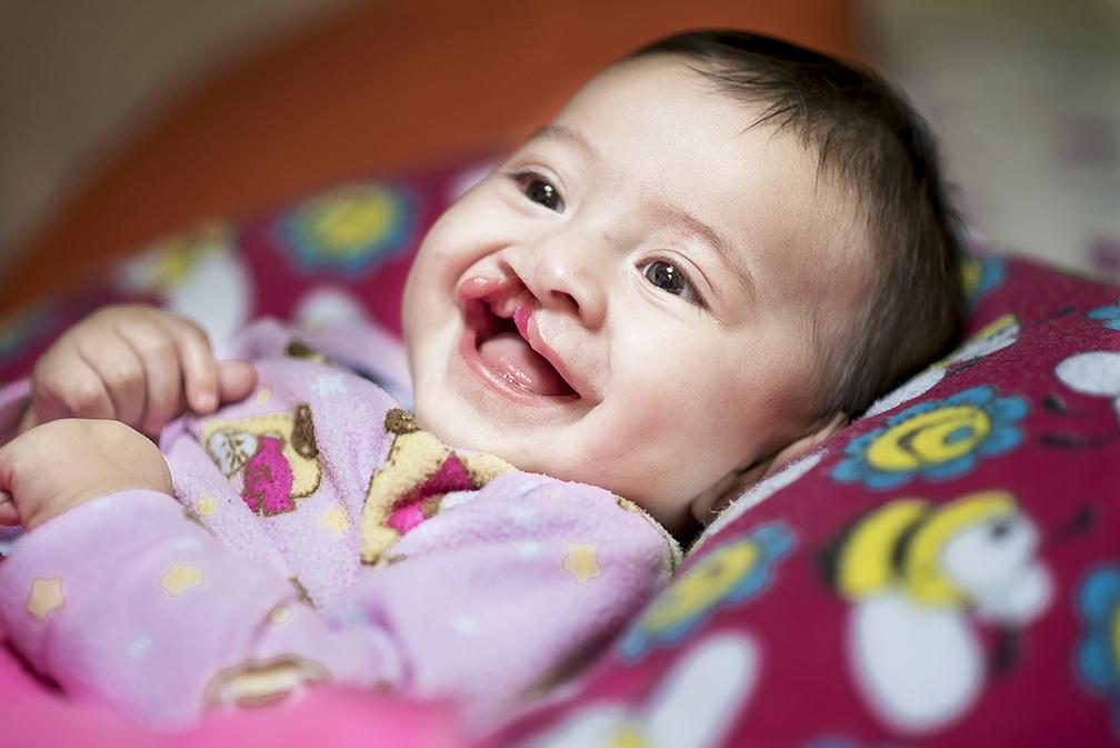 6 month old Luciana before her cleft surgery. She is smiling while laying on a cushion.