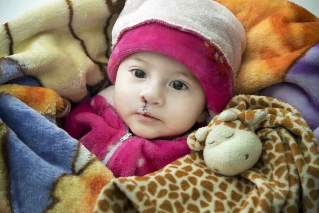 Luciana after her cleft lip surgery. She is wearing pink fleece top and hat, and is surrounded by blankets and a soft toy giraffe. 