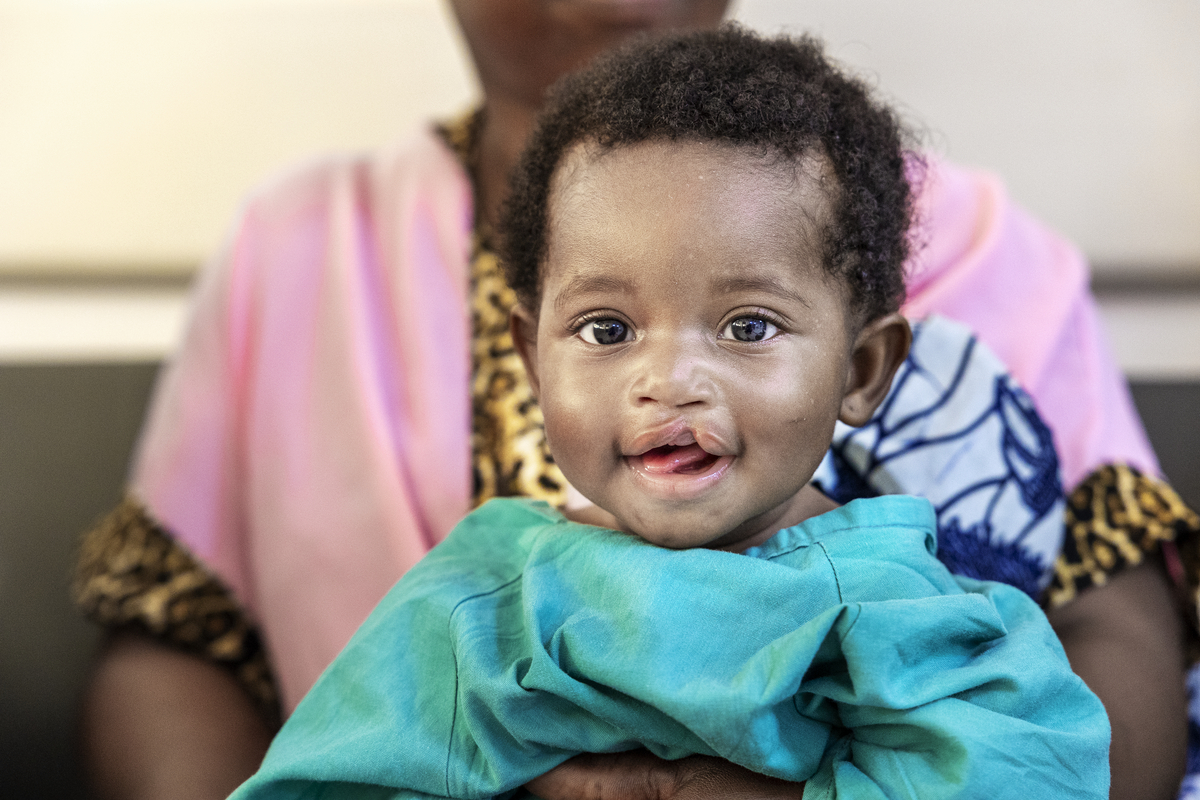 Farida before surgery. Photo: Lorenzo Monacelli