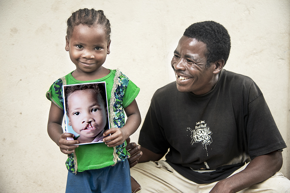 A young child with braids smiles while holding a photo of themselves before cleft lip surgery. Next to them, a smiling man in a black shirt sits against a light-colored wall.