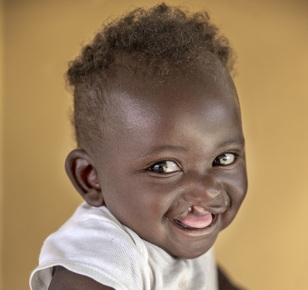 A smiling child with a cleft lip from Rwanda, wearing a light-colored shirt, looks over their shoulder against a warm, neutral background. The child has curly hair and an expressive, joyful expression.