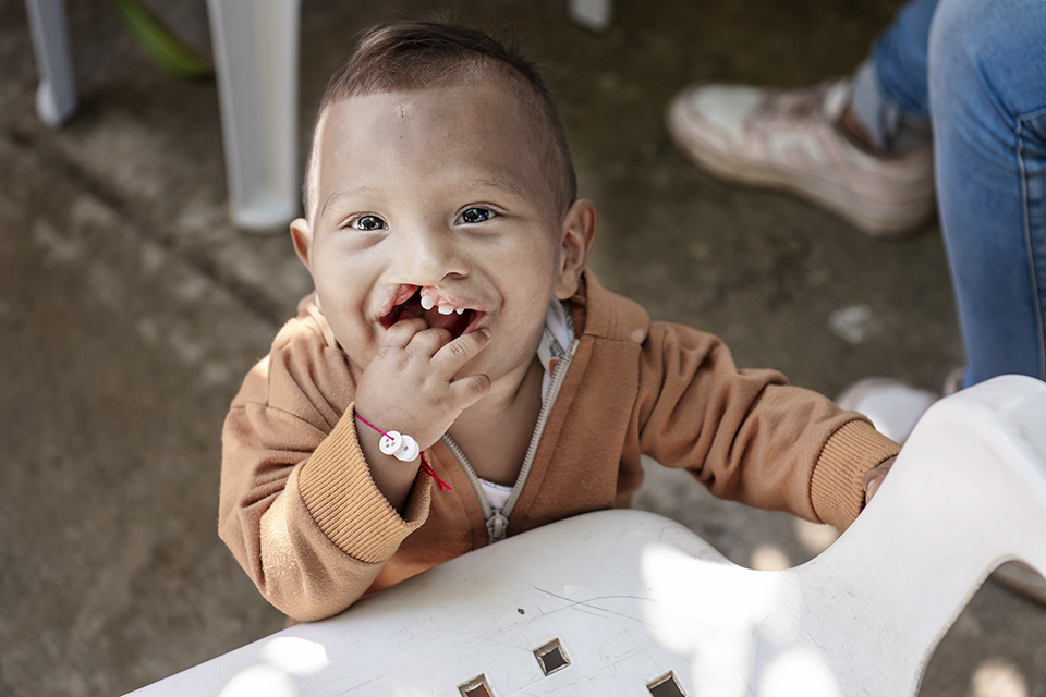 A smiling baby with a cleft lip, wearing a brown jacket and red bracelet, stands next to a white plastic chair, looking up at the camera with fingers in their mouth.
