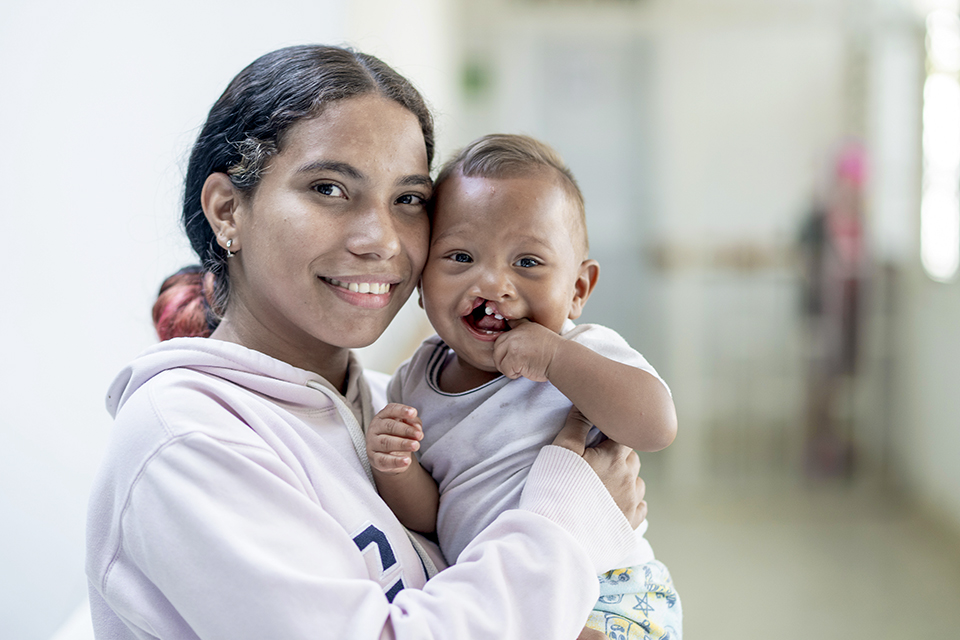 A woman smiles while holding a baby with a cleft lip. Both are looking at the camera in a bright, indoor setting. The baby is chewing on their fingers and wearing a white shirt.